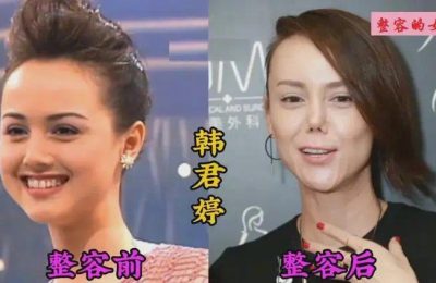 聊聊那些被整容坑惨的女星，你觉得谁最可惜？缩略图